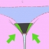 Verwyder skaamhare rondom die vagina