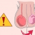 Weet of jy epididimitis het